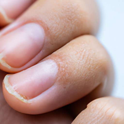 What Causes White Spots on Nails: The Truth Revealed