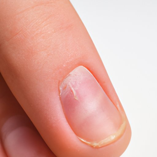 Why Do My Thumb Nails Have Dents: Causes, Treatments, and Prevention