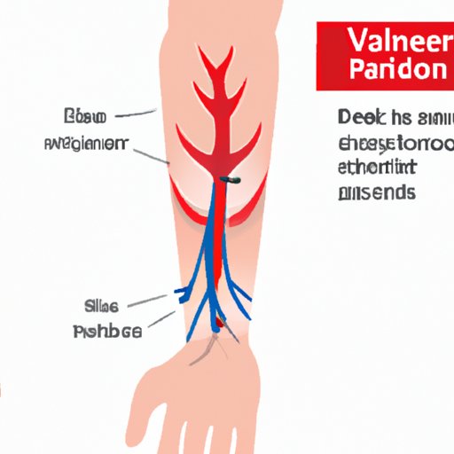 Why Do My Veins Hurt in My Arm? Understanding the Causes, Symptoms, and Treatments