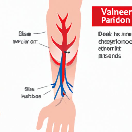 Why Do My Veins Hurt in My Arm? Understanding the Causes, Symptoms, and Treatments