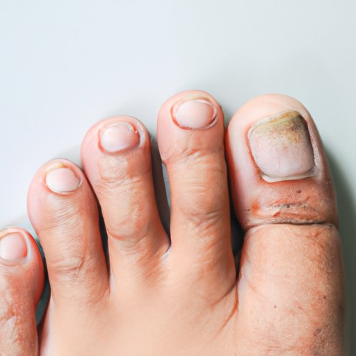 Why Do Toenails Get Thick? Understanding the Causes, Prevention, and Treatment