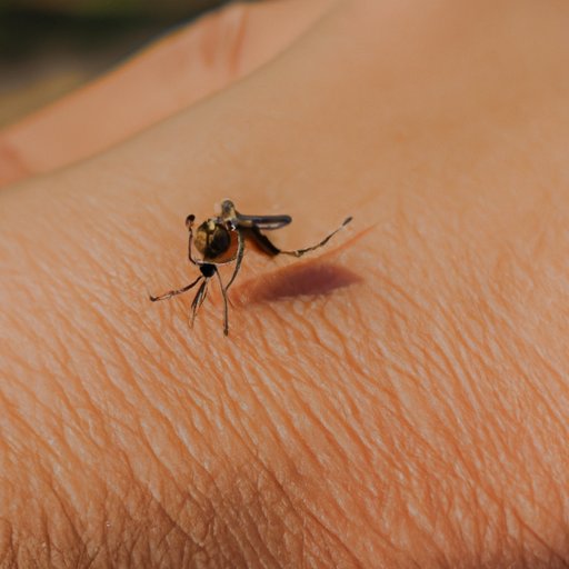 Why Do Mosquito Bites Swell? Exploring the Science and Solutions