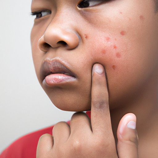 Why Does My Face Itch? Common Causes, Skin Conditions, and Prevention