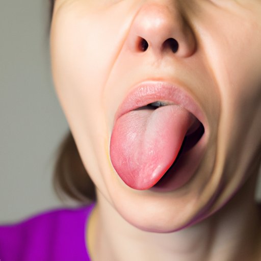 Why Does My Tongue Hurt When I Stretch It? Causes, Remedies, and Prevention