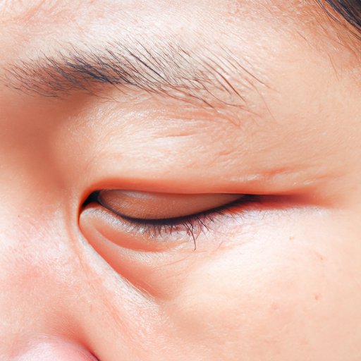 Why Does the Corner of My Eye Hurt? Understanding the Causes and Treatment Options