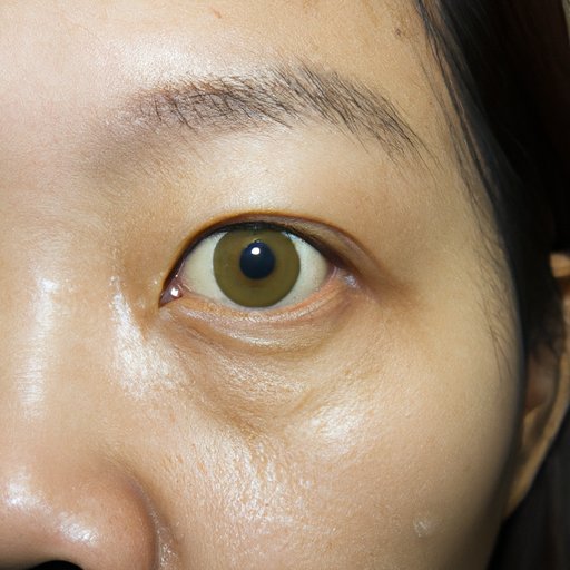 Why Is Mucus Coming Out of My Eye? Understanding the Causes and Solutions