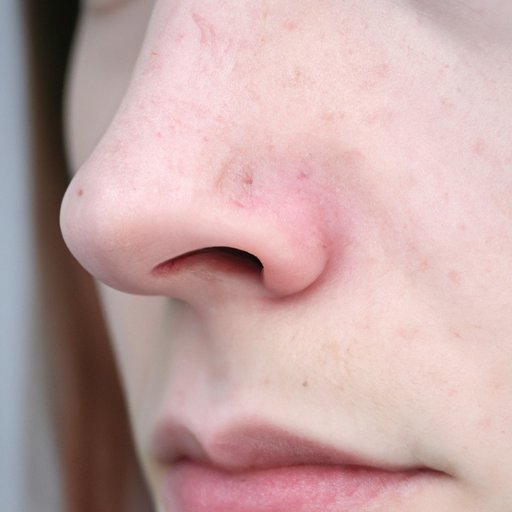 Why Is My Nose Always Red? A Comprehensive Guide to Understanding the Causes and Finding Solutions