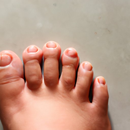 Why is my Toe Swollen? Common Causes, Treatments, and Prevention