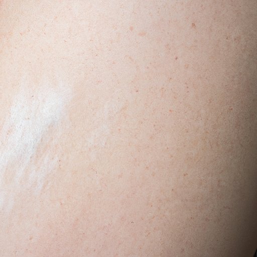 What Could a Lump in Your Armpit Mean? Understanding the Causes and Treatment Options