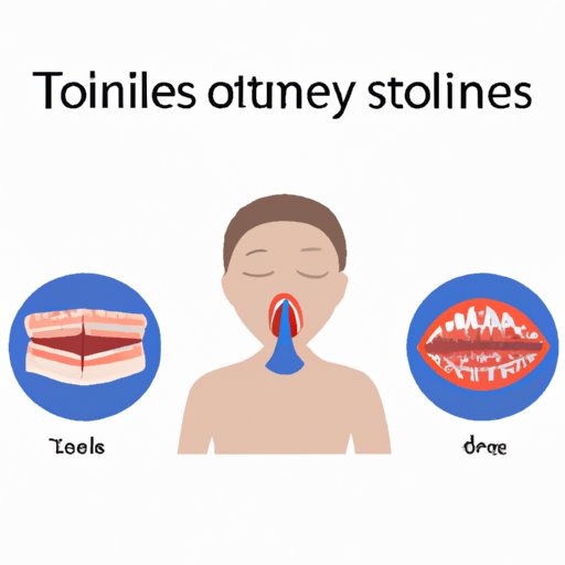 Why Remove Tonsils: Exploring Benefits and Risks of Tonsillectomy