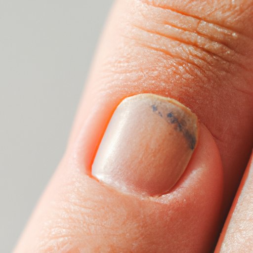 White Spots on Nails: What They Mean and How to Get Rid of Them